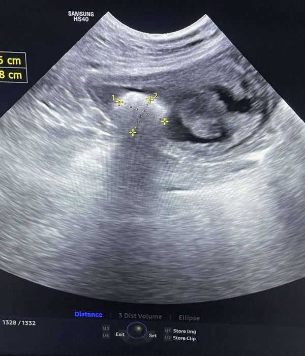 Main radiology and ultrasound 2